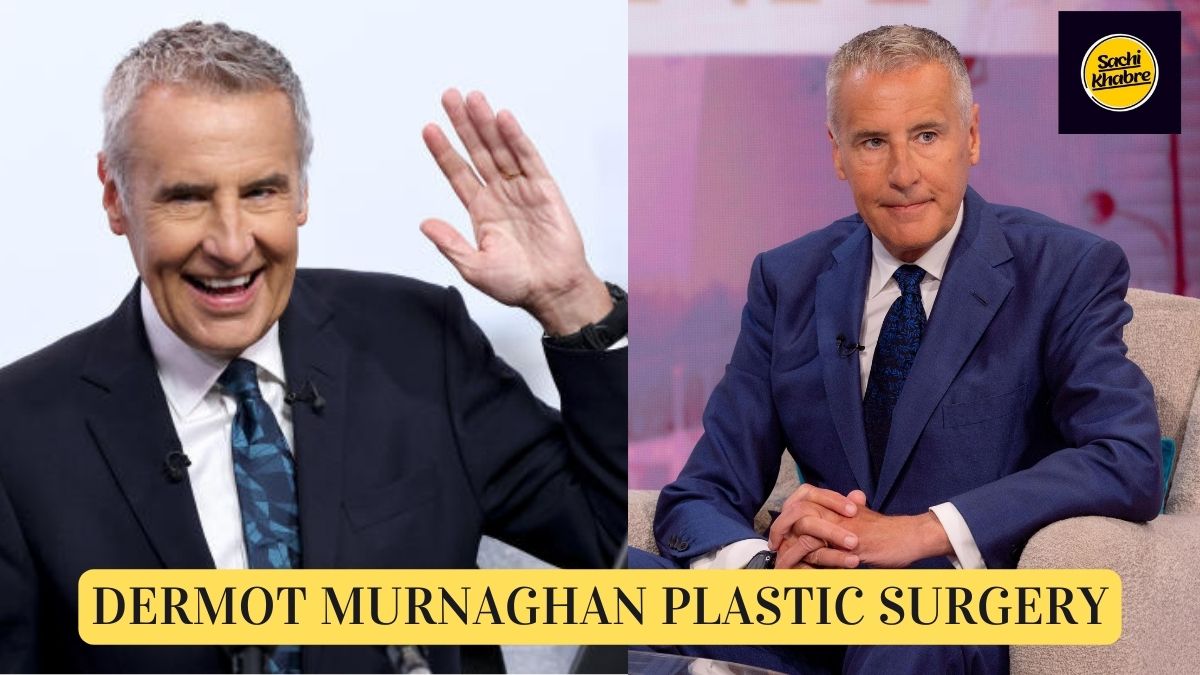 Dermot Murnaghan Plastic Surgery